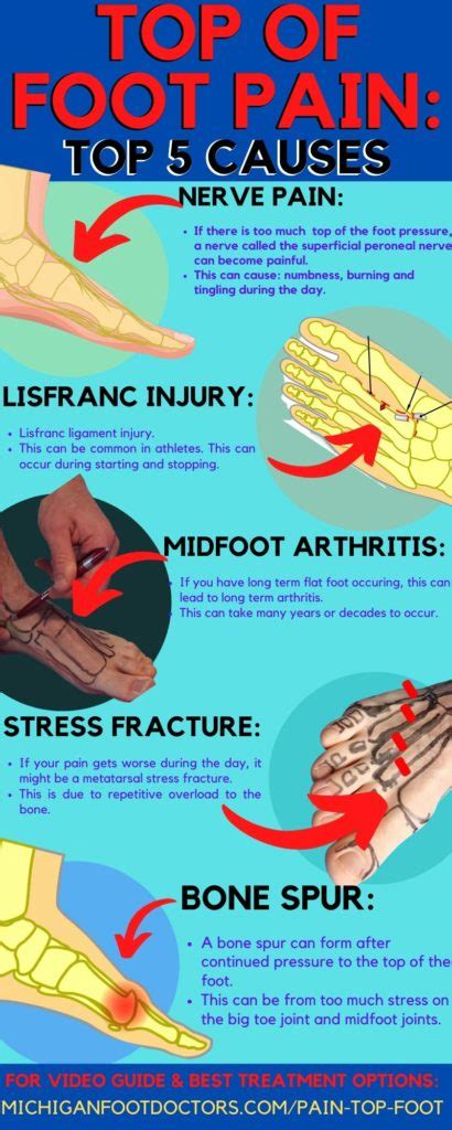 Navicular Fracture Treatment Top Of Foot Stress Fracture