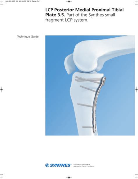 Synthes Tibial Nail Technique Guide Guides Online