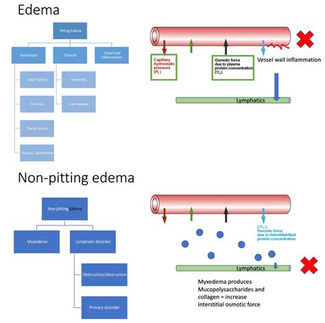Pitting Edema Stages