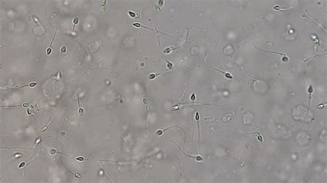 Human Live Sperms In Semen Microscopy Youtube