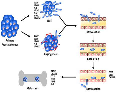 Schematic Showing The Process Of Prostate Cancer Cell Metastasis And