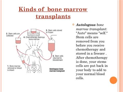 There are two main types of bone marrow. Bone Marrow