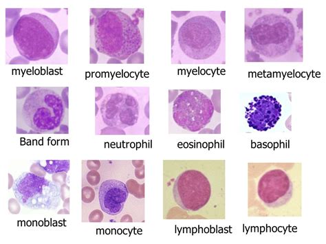 Reactive Atypical Lymphocytes Vs Monocytes
