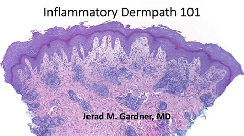 Inflammatory Dermpath 101 A Beginners Guide To Diagnosing Rashes For