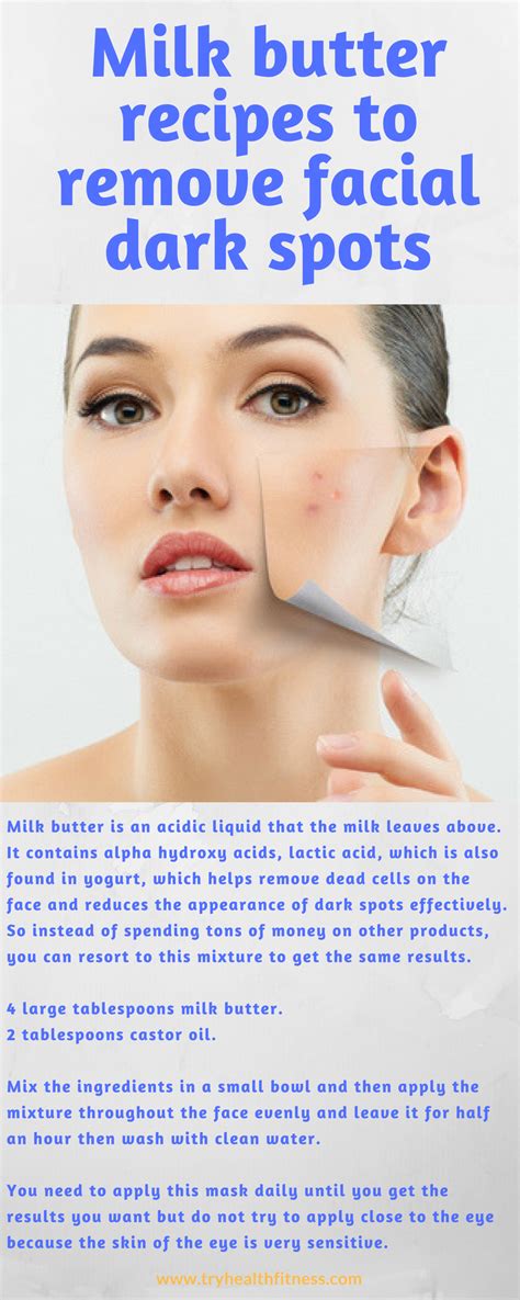 Dark Spots How To Get Rid Of Them Dark Spots Beauty Tips For Hair
