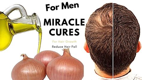 How To Re Grow Hair By Onions Juice Benefits Of Onions Youtube