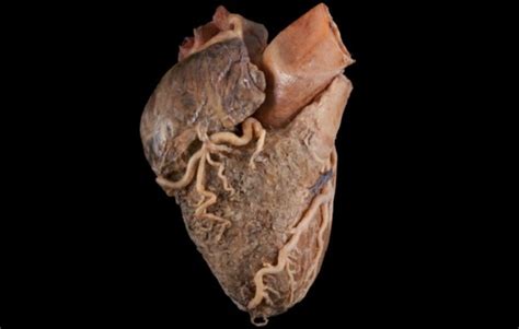 New App Lets Med Students Study Real Human Heart On Ipad