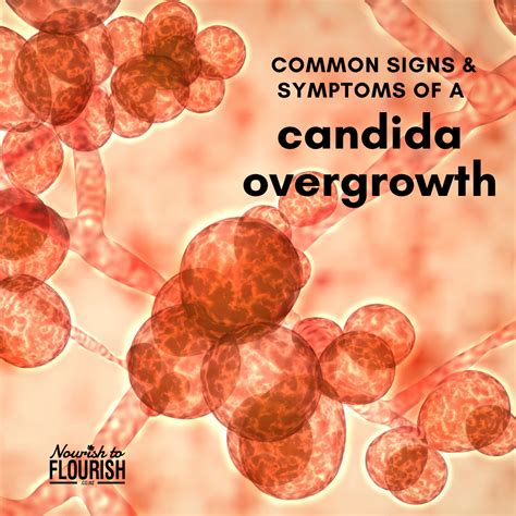 Candida Overgrowth Common Signs And Symptoms In 2020 Candida