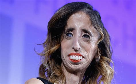 World S Ugliest Woman Says Label Was A Blessing