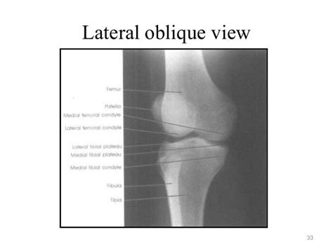 Radiographic Positioning Examples Of The Leg And Knee Ce4rt