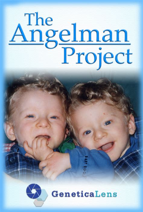 Clinical Features Of Angelman Syndrome The Angelman Project
