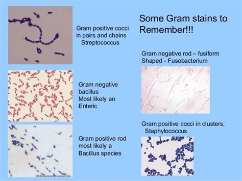 Gram Positive Cocci In Pairs