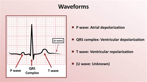 Intro To EKG Interpretation Waveforms Segments And Intervals