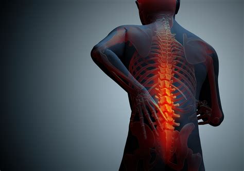 What Is Chronic Pain The Brain And Spine Institute Of North Houston
