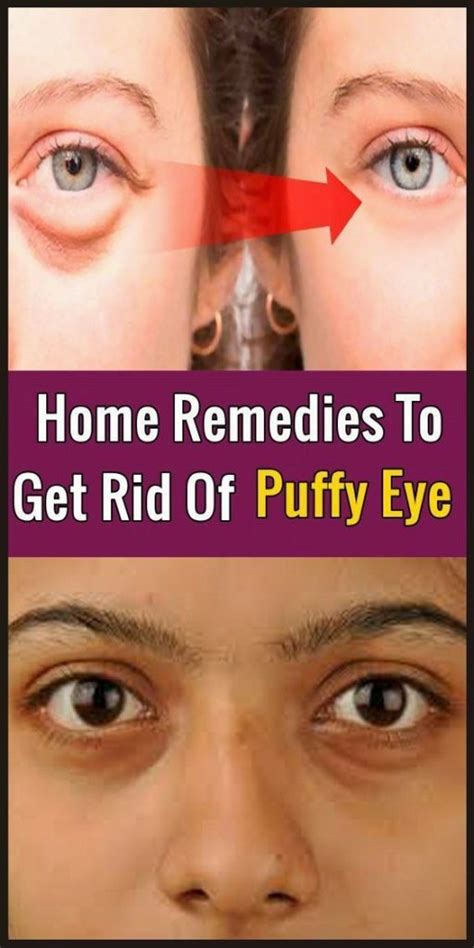 Natural Remedies To Get Rid Of Puffy Eyes Alternative Medicine