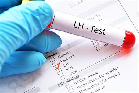 Lutropina LH za co odpowiada hormon luteinizujący
