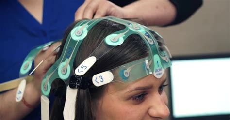 Eeg Disposable Medical Electrodes Designed To Provide Quality Recordings And To Reduce Cross