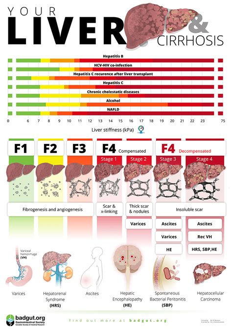 Your Liver And Cirrhosis Poster Gastrointestinal Society