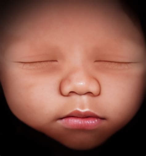 Fetal Ultraview Mother Nurture Ultrasound