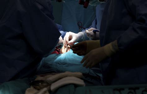 Reasons For Needing Coronary Artery Bypass Surgery