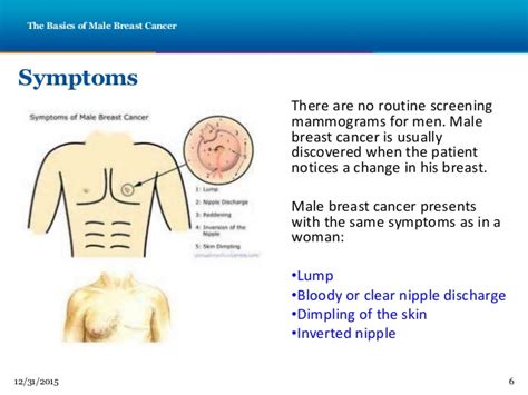 You may notice these during routine activities such as showering or changing your clothes. Tara PowerPoint Male Breast Cancer
