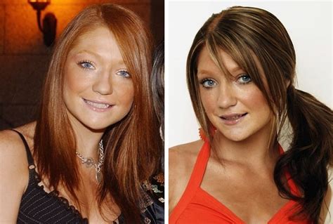 Nicola Roberts Before And After