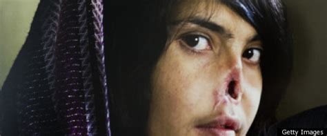 Suspect Freed In Afghan Mutilation Case