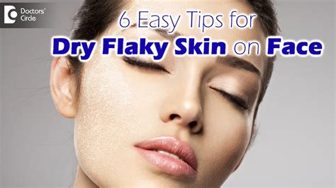 Dry Flaky Skin On Face Causes Treatment And Routine Diet Tips Dr