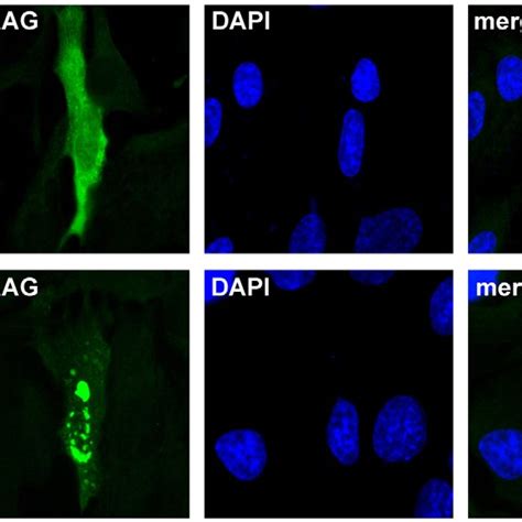 Dopamine Induces Aggregation Of Zebrafish Parkin Sh Sy5y Cells Grown