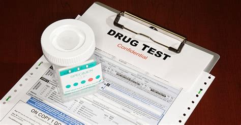 This is in the hiring paperwork. Random Drug and Alcohol Testing Procedures