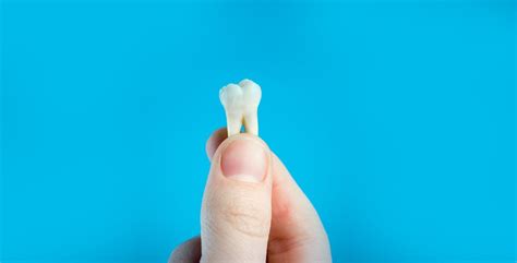 Tooth Extraction Aftercare And Recovery Tips — Starlite Dental