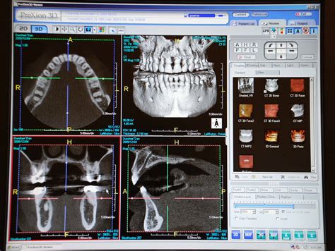 Imaging Digital X Ray Cbct And Cerec Understand The Options