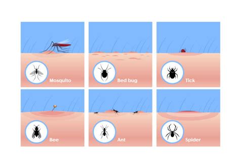 Mosquito Bite Diagram Ph