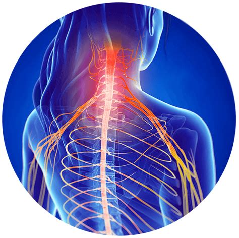 Pinched Nerve Symptoms And Advanced Spine Care