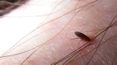 Cat fleas can definitely bite humans and this can easily happen when a cat suffering from a flea infestation comes into your home. Do Fleas Bite Humans? | PestSeek
