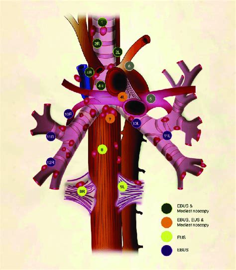 Lymph Node Map Adapted From The 2009 Iaslc Lung Cancer Staging Project