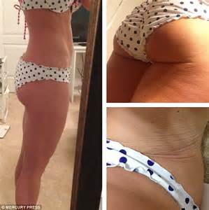 Fitness Instructors Share Photographs Of Their Cellulite And Stretch