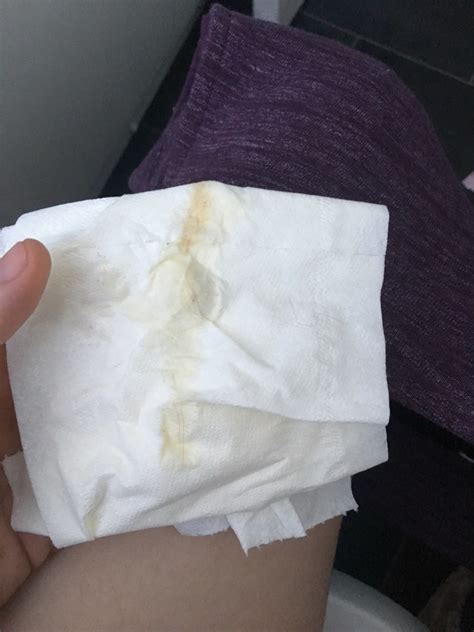 Toilet Paper Implantation Bleeding In Toilet Bowl Diy Craft