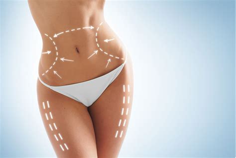 Cellulaze A New Laser Procedure To Minimize Cellulite Women Fitness