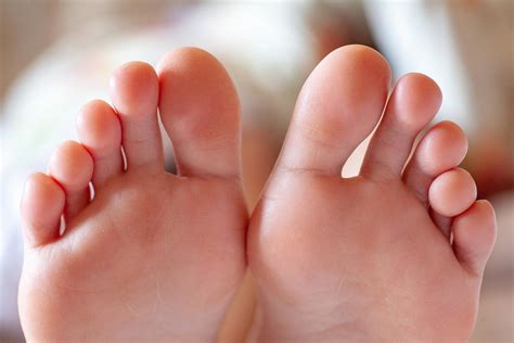 Toe Deformities In The Small Toes Causes Symptoms Diagnosis And Treatment