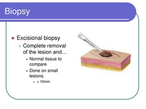 Ppt Chapter 25 Oral And Maxillofacial Surgery Powerpoint Presentation