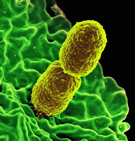 Drug Resistant And Deadly Form Of Pneumonia Discovered