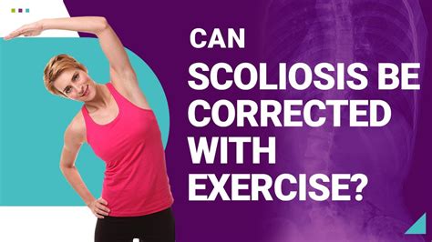 Can Scoliosis Be Corrected With Exercise Youtube