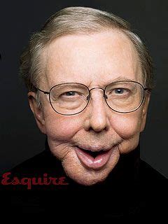 Roger Ebert Silenced By Jaw Cancer Surgery