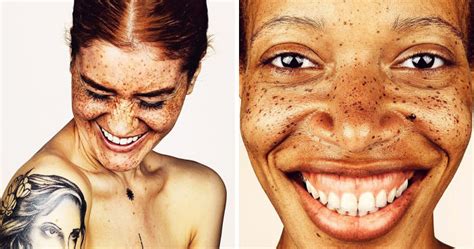 Photographer Takes Portraits Of Freckled People To Celebrate Their