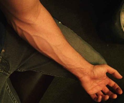 Bulging Veins In Hands And Arms