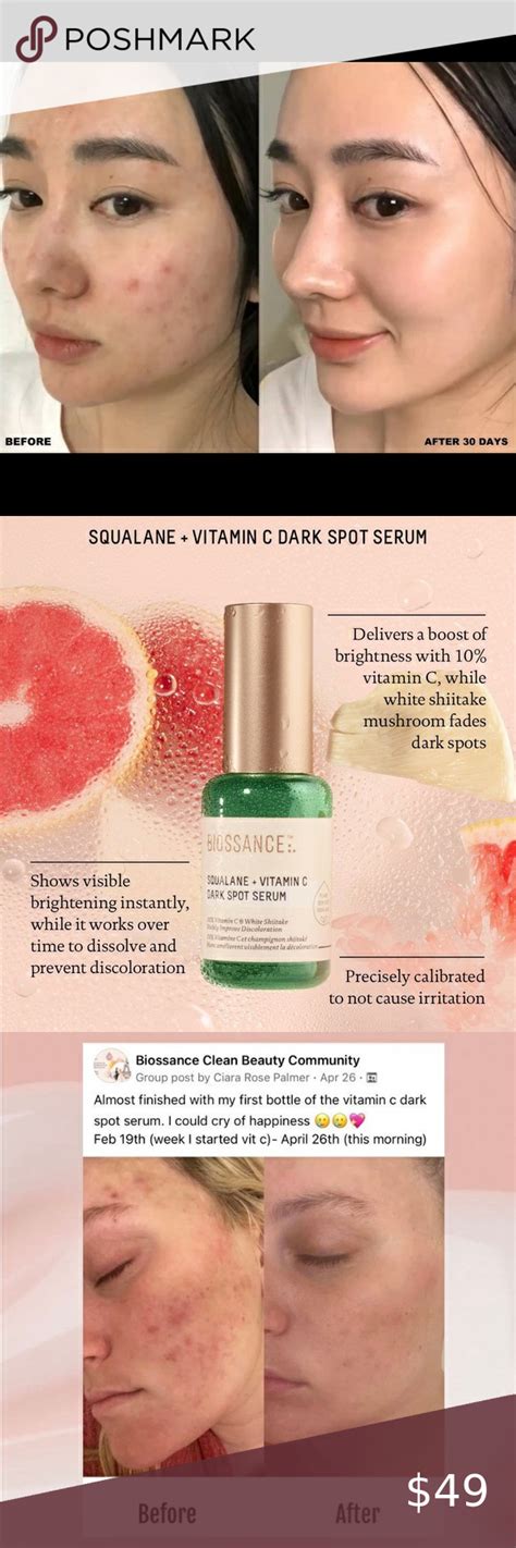 🥇award Winning🥇 Biossance Squalane Vitamin C Dark Spot Serum 10ml