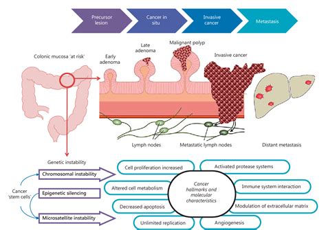Molecular Pathways And Cellular Metabolism In Colorectal Cancer