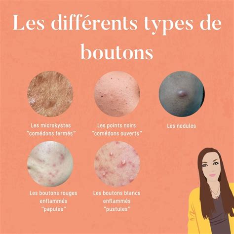 Acné Les Différents Types De Boutons The Good Balance