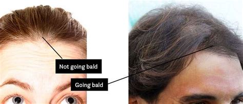 You can easily tame thick hair by thinning it with shears Am I Going Bald? How to Know if You're Going Bald